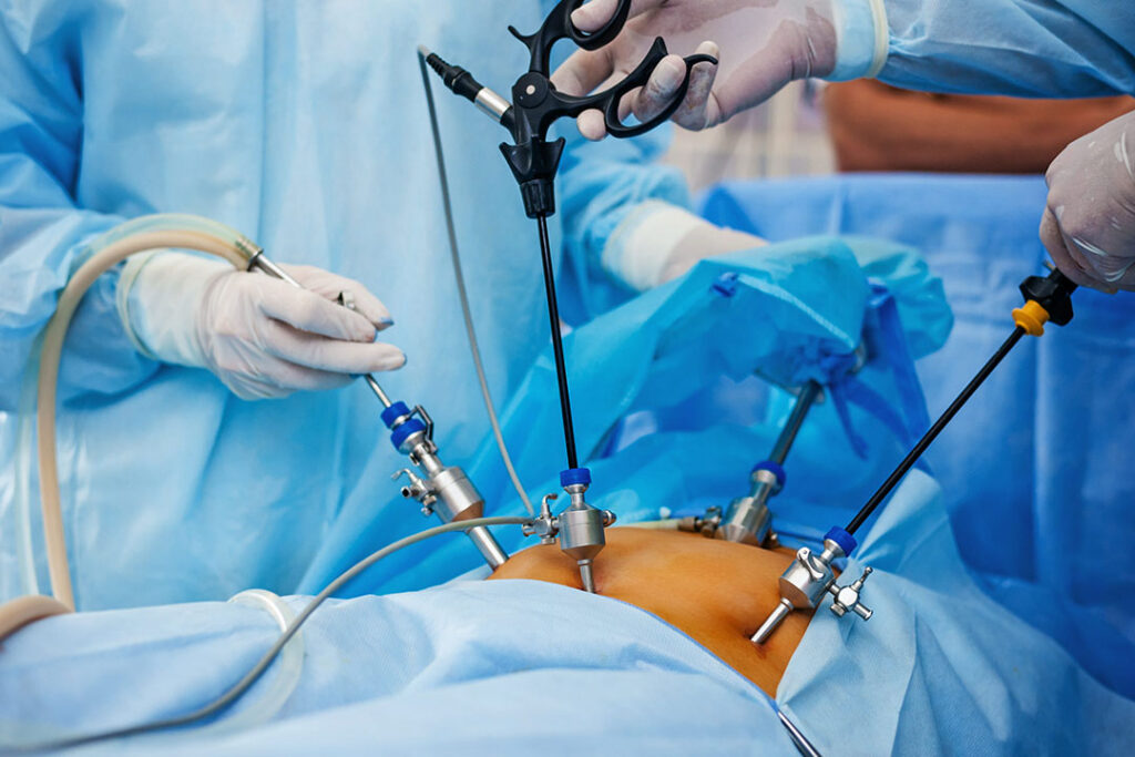 Minimally Invasive Gynecology