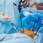 Minimally Invasive Gynecology