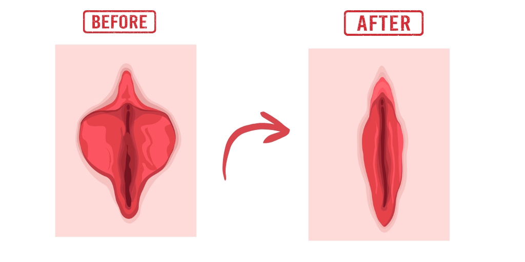 Vaginal Rejuvenation services in kanpur