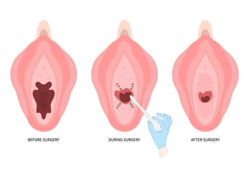 Gynecologist for vaginal wellness in Kanpur