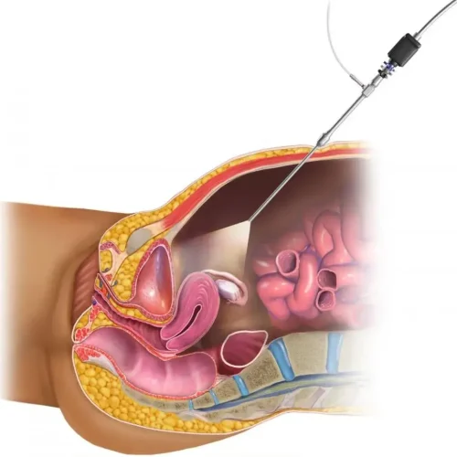 Pregnancy Care by Gynecologist in Kanpur